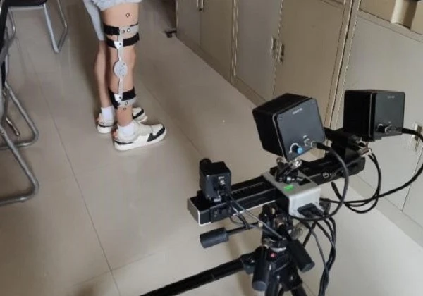 DIC技术用于人体腿部支架位移运动轨迹追踪